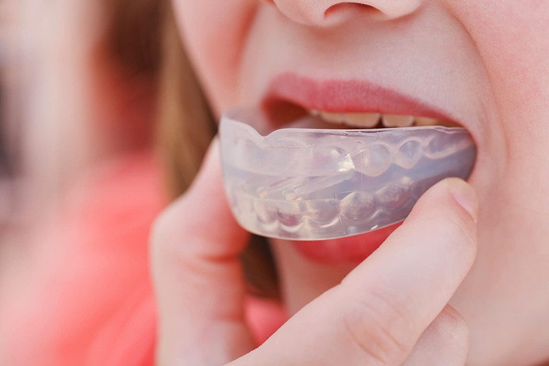 sports mouth guard