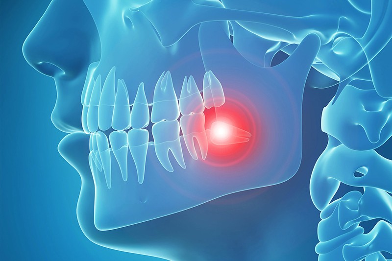 tmj treatment