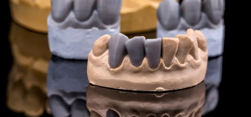 diagnostic wax up tooth models