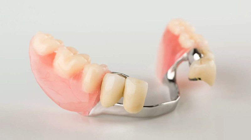 Partial Dental Dentures Auburn, WA - NuttallSmiles