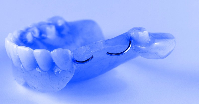 partial dentures