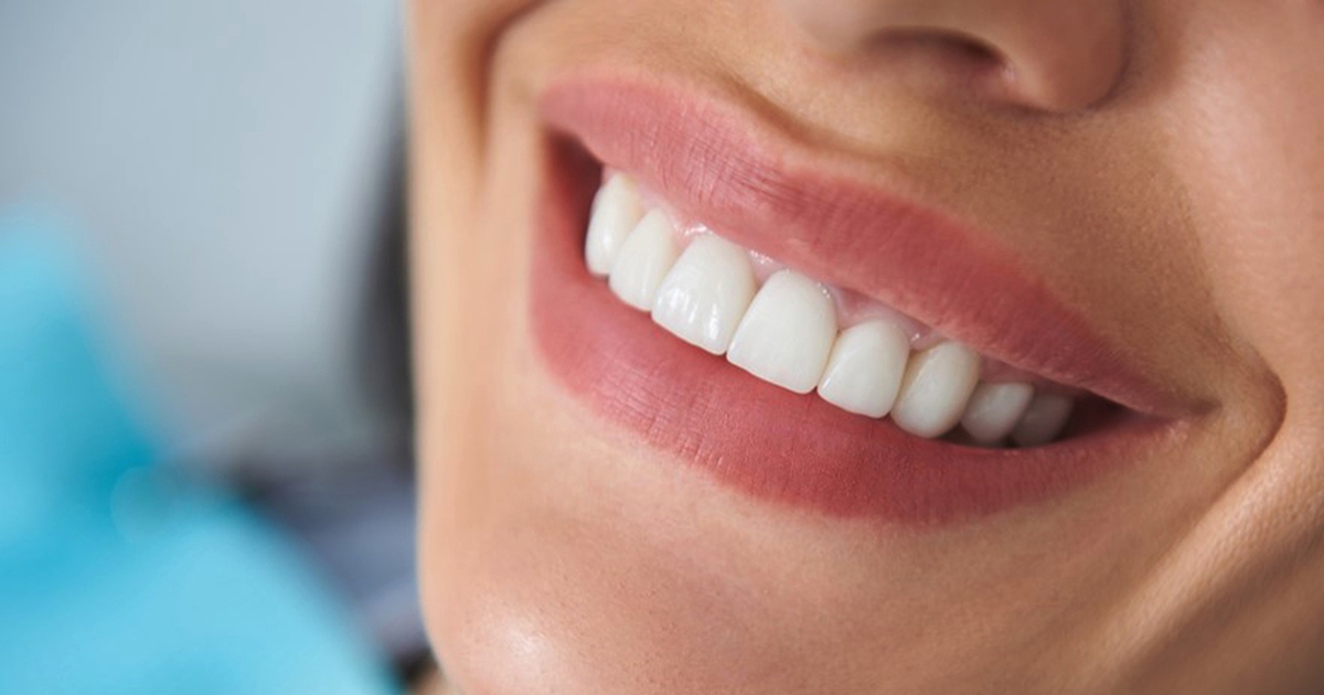 Dental Bonding In Auburn, WA NuttallSmiles