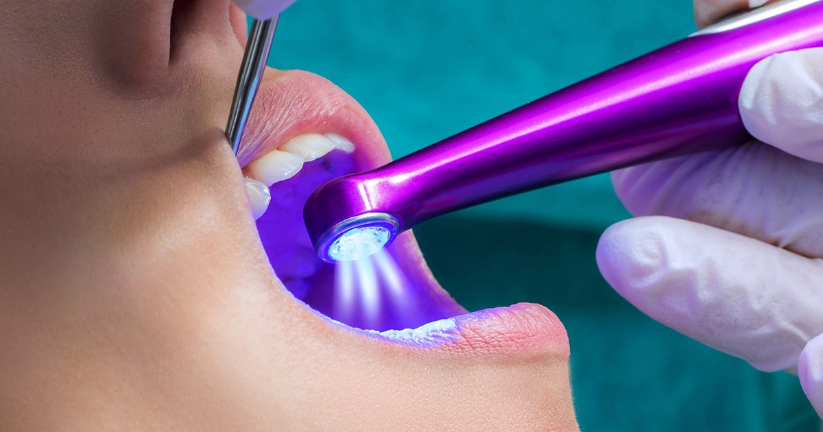 Dental Sealants Auburn WA Dental Sealants For Adults NuttallSmiles